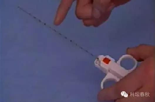 前列腺癌超强科普贴,耐受性前列腺癌治疗已经出现曙光