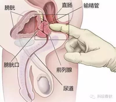 前列腺癌超强科普贴,耐受性前列腺癌治疗已经出现曙光